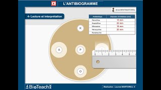 Tout savoir et comprendre sur lantibiogramme → Version courte← [upl. by Arlette]