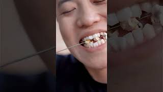 MADE POPCORN CLEAN AND HYGIENICEAT BROADCASTMUA ĐƯỢC GÌ VỚI 1 ĐỒNG [upl. by Liarret]