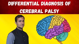 Cerebral palsy approach and differential diagnosis [upl. by Eanore]