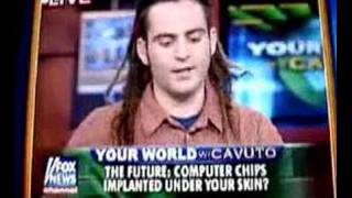 RFID Implant  Fox News  Mikey Sklar [upl. by Huntley]