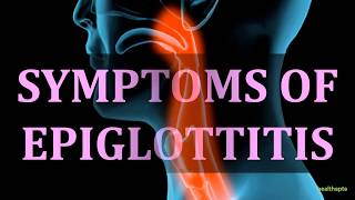 SYMPTOMS OF EPIGLOTTITIS [upl. by Namien382]