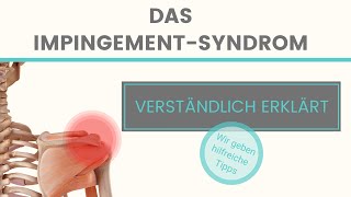 Impingement Syndrom der Schulter Erklärung und Hilfe von Schulterhilfede [upl. by Neri]