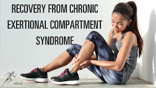 Recovery from chronic exertional compartment syndrome CECS [upl. by Sami]