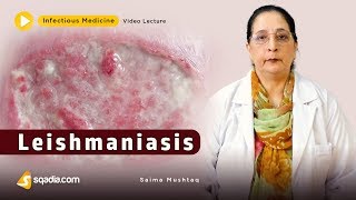 Leishmaniasis  Infectious Clinical Medicine Video  VLearning  sqadiacom [upl. by Bevus]