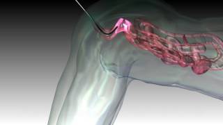 colonoscopy colon colonoscope endoscope 3d medical animation company studio 3d visualization healthc [upl. by Anaerdna]