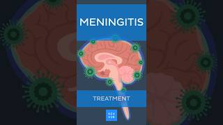 Meningitis Treatment  Kenhub meningitis [upl. by Aslin]