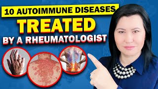 Top 10 Autoimmune Diseases A Rheumatologist Diagnose and Treat [upl. by Eidnam544]