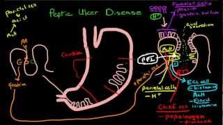 Peptic Ulcer Disease Pathophysiology [upl. by Ennairej]