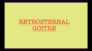 RETROSTERNAL GOITRE [upl. by Marla]