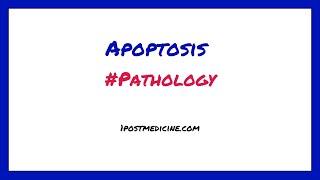 Apoptosis  Pathology [upl. by Sajovich]