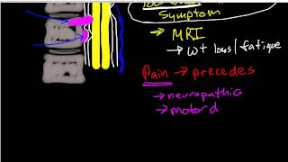 Oncologic Emergencies Spinal Cord Compression [upl. by Anev]