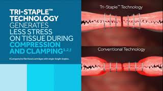 The Impact of TriStapleᵀᴹ Technology on Tissue [upl. by Trin]