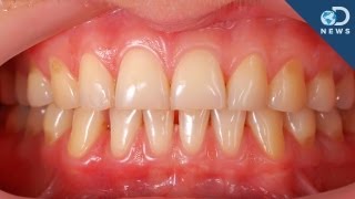 Teeth and Gums Regeneration Tooth  RIFE Frequencies Treatment  Energy amp Quantum Medicine [upl. by Adni665]