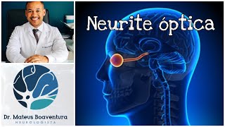 Tudo sobre neurite óptica [upl. by Ahsinrev32]