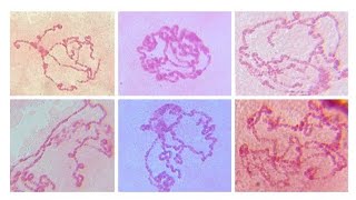 Images of polytene chromosome of Drosophila sp X150 X400 amp X1000 [upl. by Raoul]