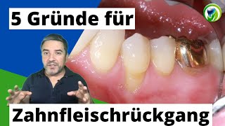 5 Gründe für Zahnfleischrückgang Zahnfleischentzündung Parodontitis KFO Überbelastung Putzen [upl. by Atelra]