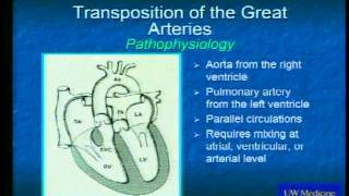 Congenital Heart Disease in Adults [upl. by Midge896]