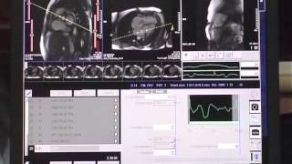 How to perform a cardiac MRI study [upl. by Solly]