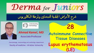 028 Lupus Erythematosus LE Autoimmune Connective tissue diseases [upl. by Nellie]