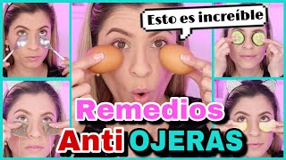 TRUCOS Y REMEDIOS CASEROS PARA ELIMINAR LAS OJERAS  ELIMINAR OJERAS EN CASA  NatyGloss [upl. by Wildee688]