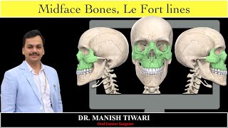 Le fort III fracture line  StayHome and learn WithMe [upl. by Silohcin]