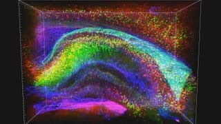 3D analysis of intact mouse hippocampus [upl. by Januisz]