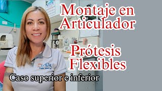 Montaje en articulador para prótesis flexible [upl. by Ricky]