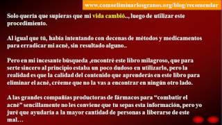 Como quitar espinillas de la cara fácilmente y para siempre [upl. by Harol]