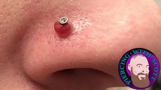 Piercing Bumps  Everything You Need To Know [upl. by Erwin]