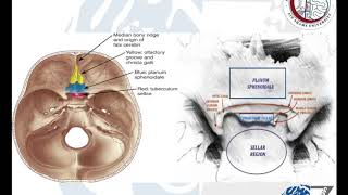 Brain Tumours 33 Meningiomas 7 Tuberculum SellaePlanum SphenoidaleOlfactory Groove [upl. by Oremoh]