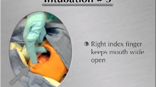 Endotracheal Intubation Video  MedicalGeekflv [upl. by Arlina]