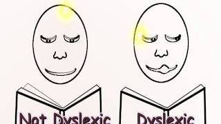 Animation A Dyslexic Brain Uses Five Times More Area to Read [upl. by Eessac]