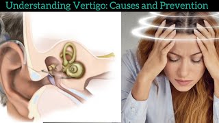 Understanding Vertigo Causes and Treatment Options [upl. by Armington]