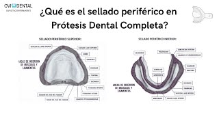 ¿Qué es el SELLADO PERIFÉRICO en PRÓTESIS DENTAL COMPLETA  LA GUÍA PASO A PASO [upl. by Broeder233]