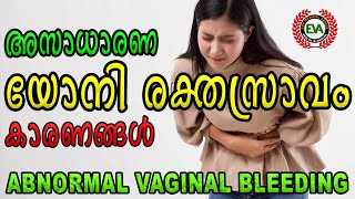 ABNORMAL VAGINAL BLEEDING I അസാധാരണ യോനി രക്തസ്രാവം Iഗർഭാശയ രക്തസ്രാവം I UTERINE BLEEDING I കാരണങ്ങൾ [upl. by Calhoun225]