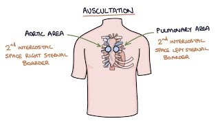 Heart Murmurs and Heart Sounds Visual Explanation for Students [upl. by Nage650]