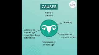 Things You Need to Know About Cervical Cancer  CARE Hospitals [upl. by Ardnua]