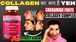 carbamide forte collagen review  Best Collagen Supplement in India [upl. by Bazar833]