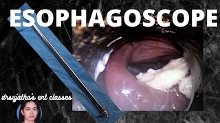 104Rigid esophagoscopy  Indication Contraindication Procedure steps oesophagus scopy [upl. by Nnarefinnej]