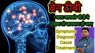 Brain TB  Tubercular Meningitis  TBM  Tuberculoma  TB specialist  Tuberculosis in hindi [upl. by Rimat36]