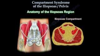 Iliopsoas Pelvic Compartment Syndrome Everything You Need To Know Dr Nabil Ebraheim [upl. by Ennoid474]