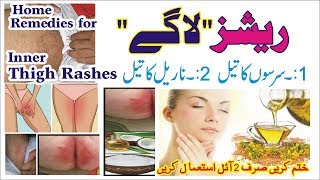 Rashes Ka Asaan Nuskha  vigina rash I Baby rash  How to Get Rid in under Legs rash I skin itchy [upl. by Ynnattirb321]