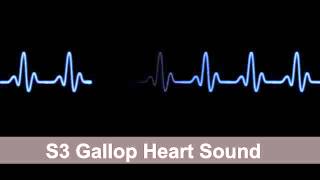 S3 Gallop Heart Sound Collection For Auscultation Skills [upl. by Aeslahc]