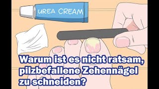 Warum ist es nicht ratsam pilzbefallene Zehennägel zu schneiden [upl. by Aeslahc280]