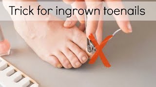 How to Fix Ingrown Toenails Easily [upl. by Nidnal429]