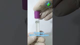 CBC tube  EDTA Anticoagulants  EDTA Vial  CBC test  Blood collection tube  EDTA vacutainer [upl. by Nageem]