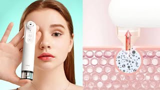 Прибор для чистки лица Xiaomi inFace Visual Blackhead Remover [upl. by Ellehcor602]