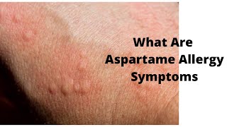 What Are Aspartame Allergy Symptoms [upl. by Fabri29]