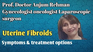 Fibroids Symptoms amp Treatment options [upl. by Auhsej362]