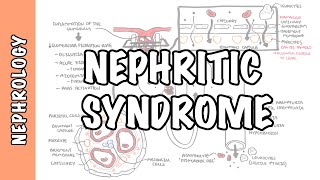 Nephritic Syndrome  classification pathophysiology treatment RPGN ANCA Immune complex [upl. by Atilef]